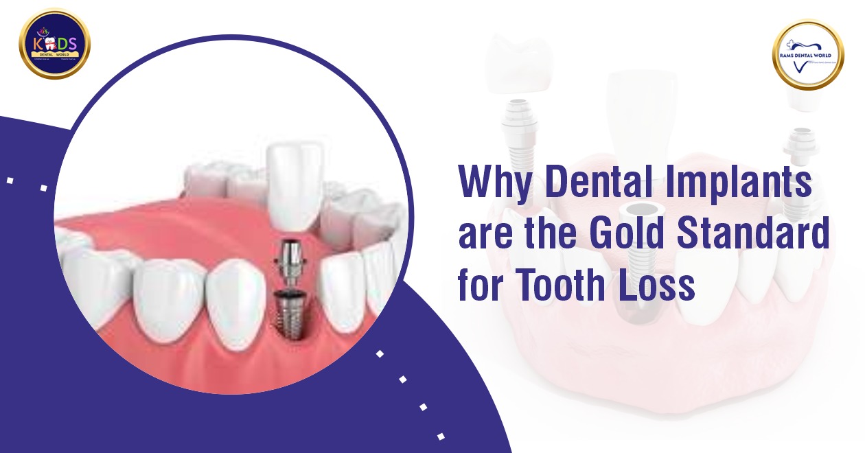 Why Dental Implants Are the Gold Standard for Tooth Loss?