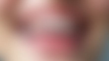 Preventing Gum Disease: Best Practices