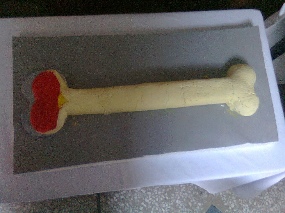 3D Bone