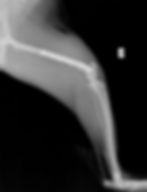 プレートによる固定