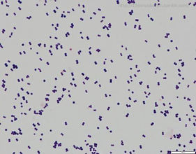 Staphylococcus psudintermedius.jpeg