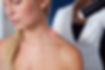 Closeup of localized cryotherapy session to the neck of young woman. Ice cold nitrogen vap