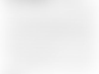 Profissionais Oftalmologistas se Propõem a Fazerem Exames de Vista Gratuito em Juara