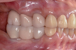 After (Final restoration) 1