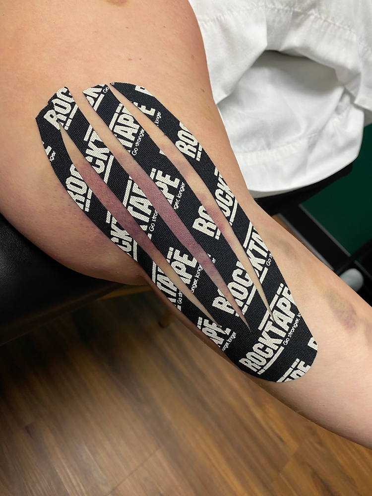 Does Kinesiology Tape Really Work???
