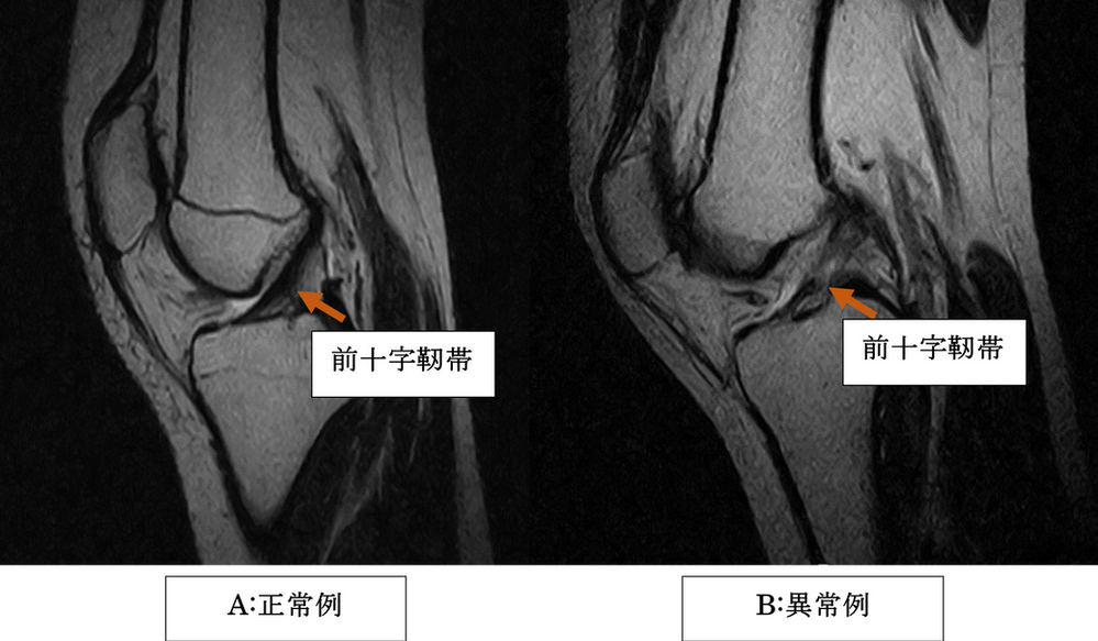 整形外科で診るMRI
