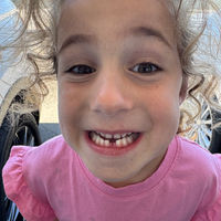 5 year old with missing front tooth