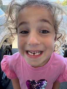 5 year old with missing front tooth