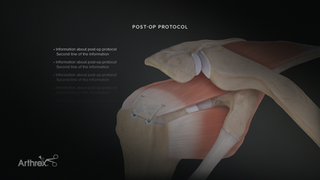 Post-Op-Protocol_Template-Mockup_2021_C-02.png
