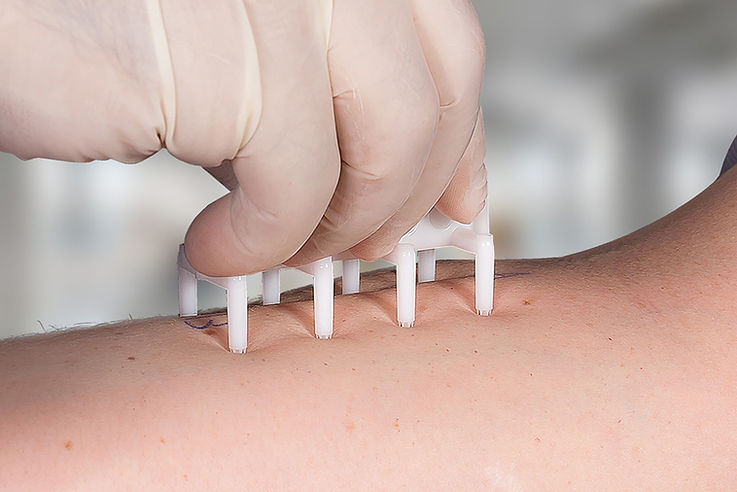 Prick Test.jpg