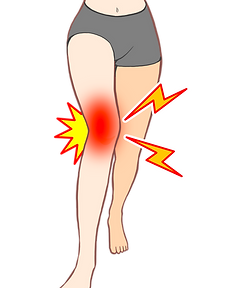 膝の痛みで赤くなっているイラスト