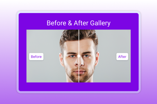Before & After banner