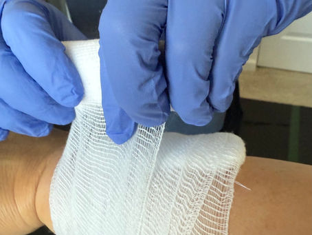 First Aid for Common Toddler InjuriesÂ