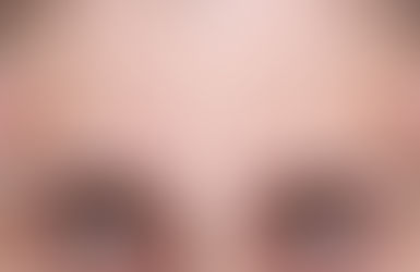 Aging Challenges: Common Wrinkle Concerns and How to Address Them