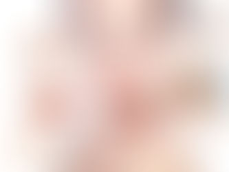 HIFU Before and After: How Long Do Results Last?