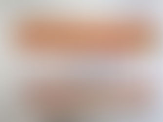 生え癖を治す技術！？ヘアリセッターとは