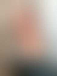 手荒れで悩むことなんてなくなる！？