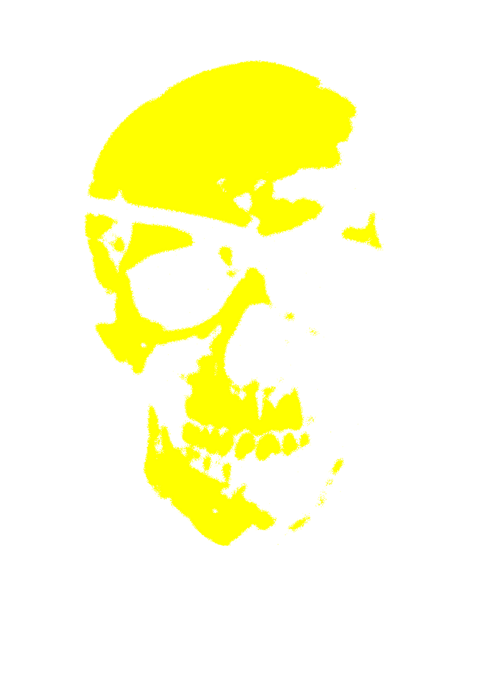 Acid skull solo.png