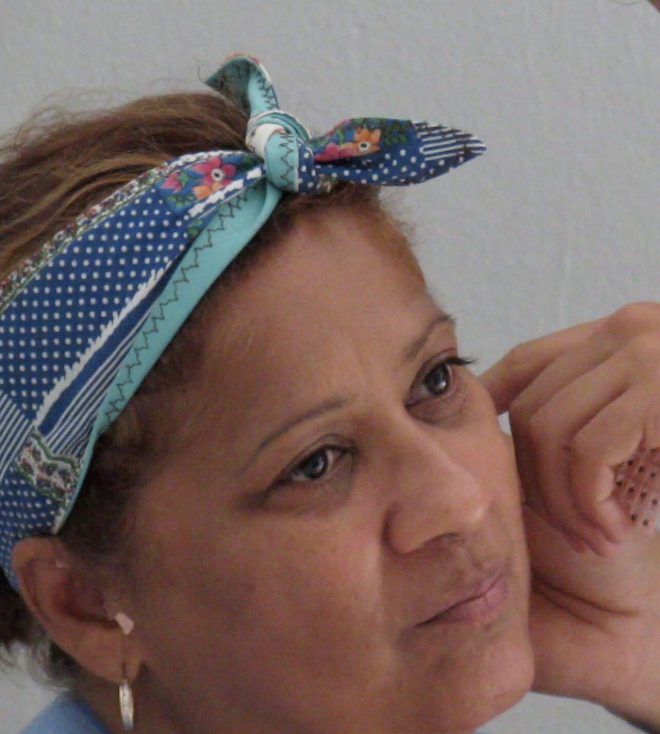 Evelyn with acupressure seeds