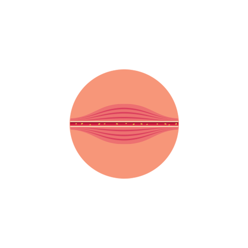 HIPEM over muscle fibers.gif