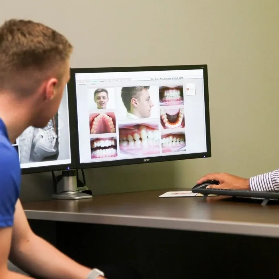 Caring for Your Braces: Everyday Tips for Healthy Teeth During Treatment