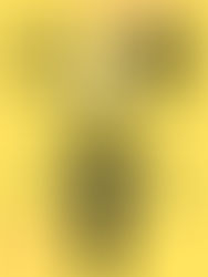 一位精神科醫生正在溫和地與患者交談,患者表情困惑,醫生耐心解釋幻覺的科學成因,背景有大腦結構圖示。