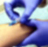 Gloved hands placing an IV catheter into a vein in an arm.