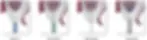 lateral7.webp