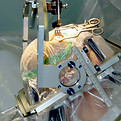 Parkinson_surgery.jpg