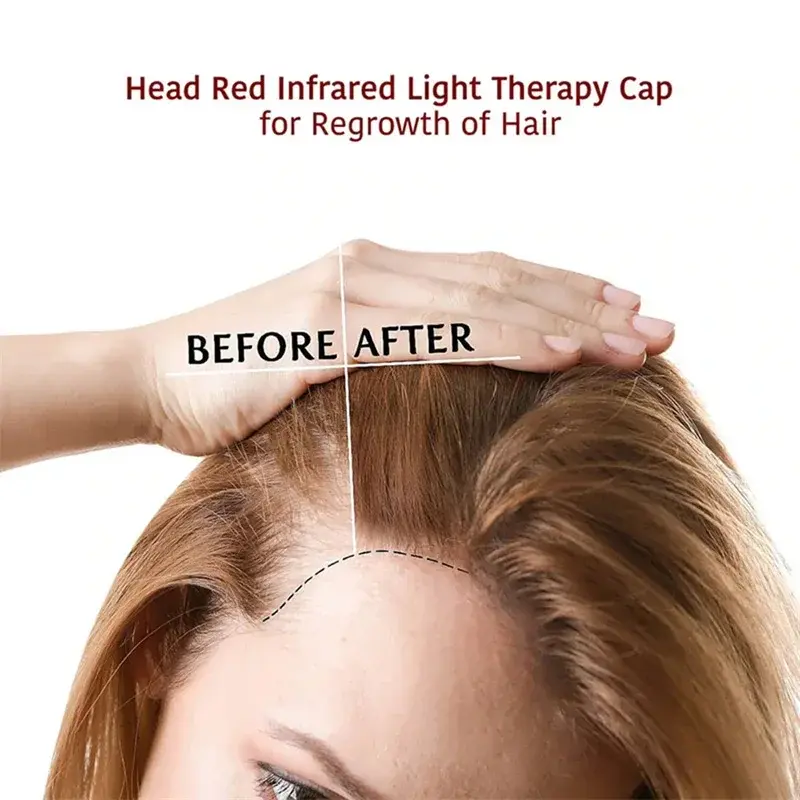 Thumbnail: ✨ Valora™ Red Light Hair Therapy Cap