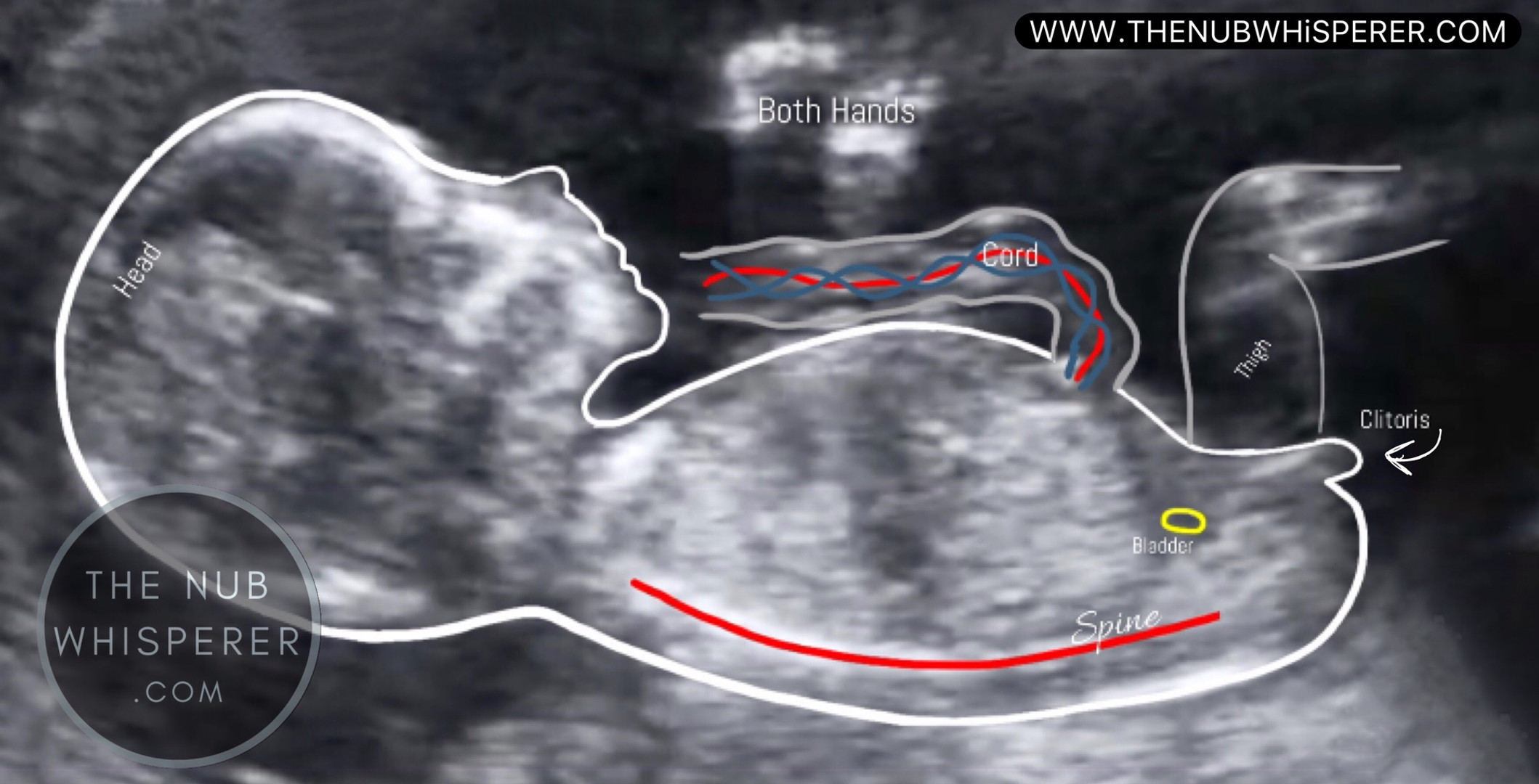 Nub Theory THE NUB WHISPERER LTD