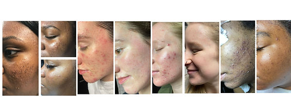 Skin Haven RX customer results