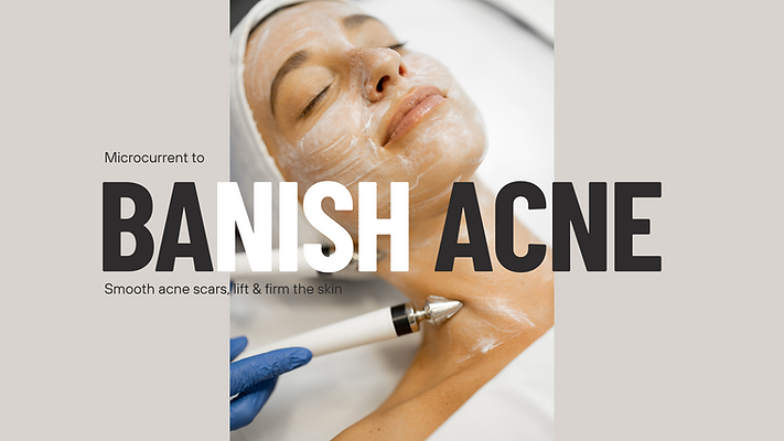 Microcurrent acne facial st louis mo luxe haven skin haven rx