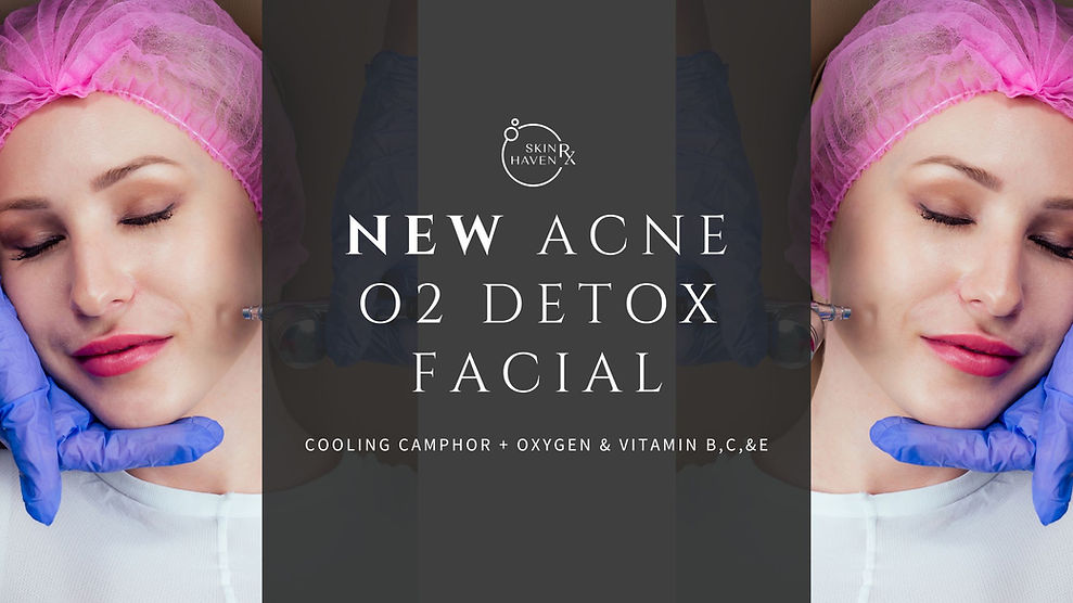 oxygen facial for acne