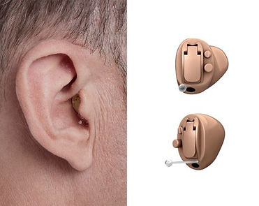 Completely in the canal