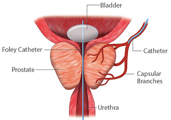 bladder.png