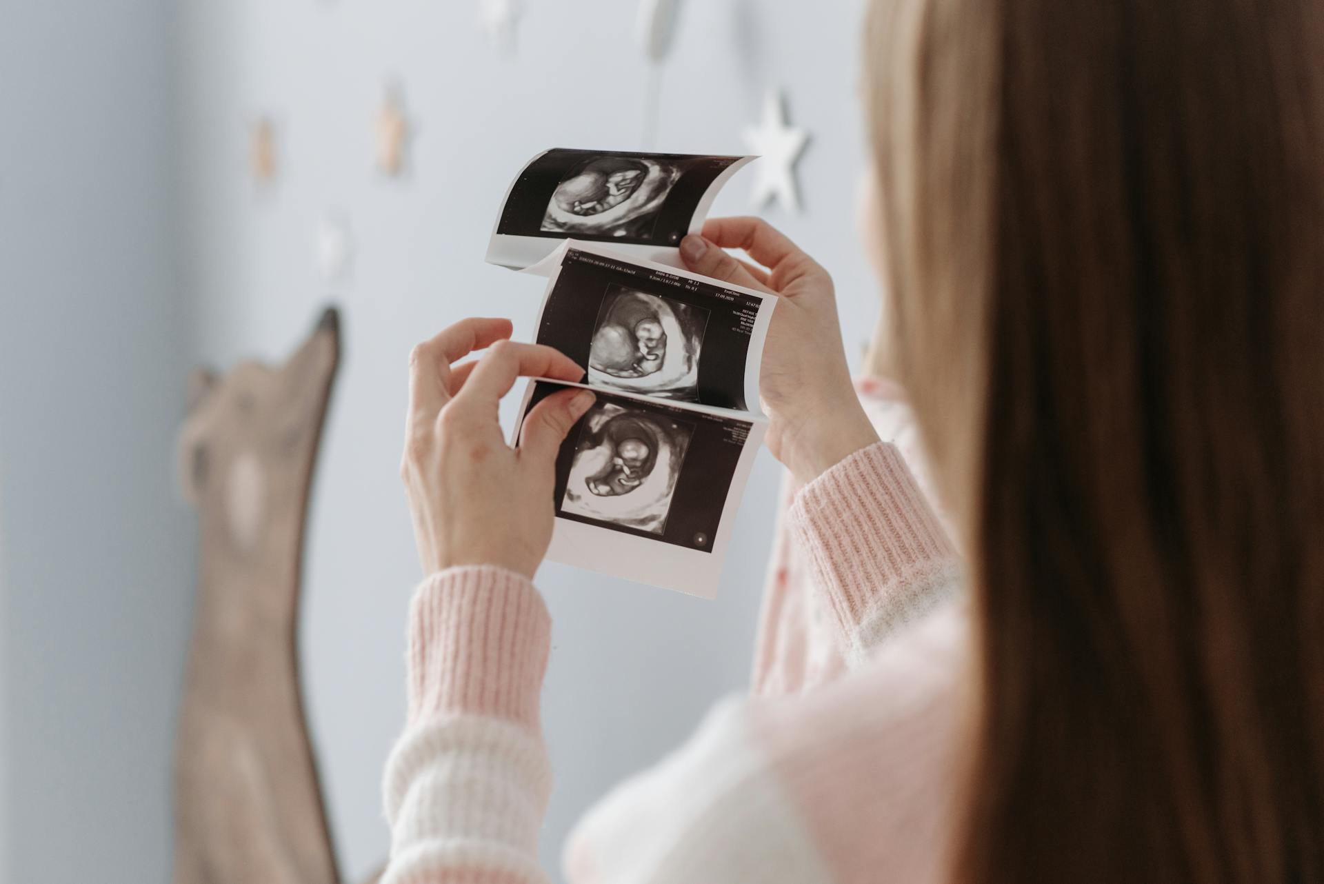 A woman holding an ultrasound image confirming early pregnancy