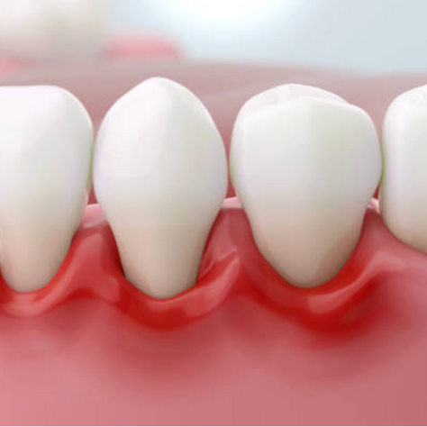 How to Know If You Need a Deep Cleaning