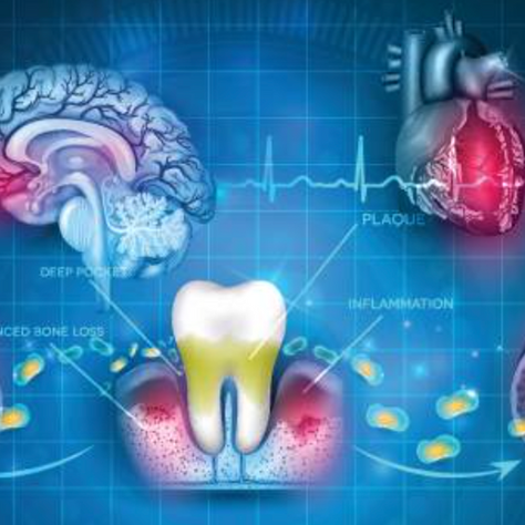 The Hidden Connection Between Gum Health and Your Overall Well-Being