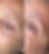 Nano Brows before and after results showing defined, volumized eyebrows using needle technique in To