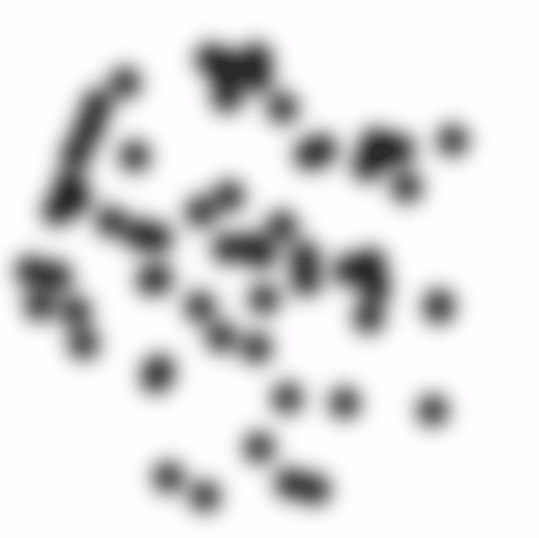 postop_50_deg_1cpd[1].gif