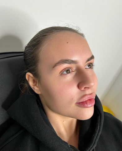 Hydrafacial in Wolverhampton