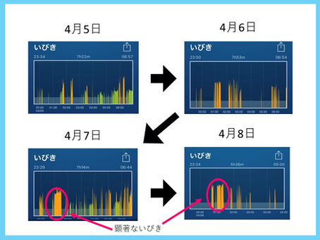 鍼灸でいびき改善