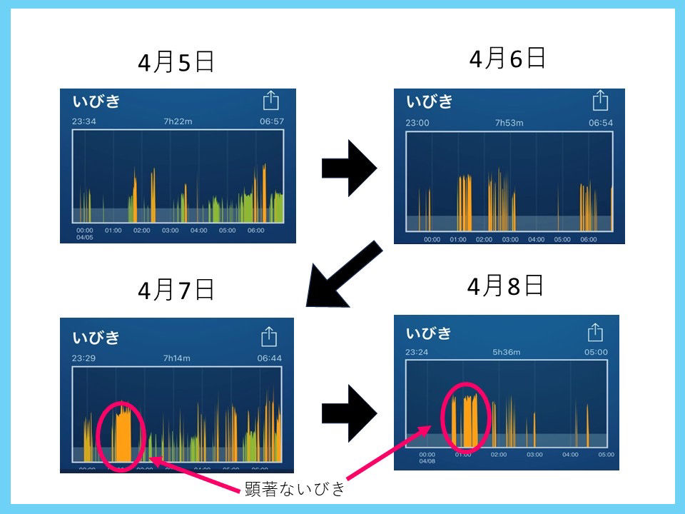 鍼灸でいびき改善