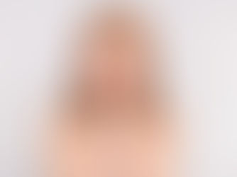 Aplikace botulotoxinu