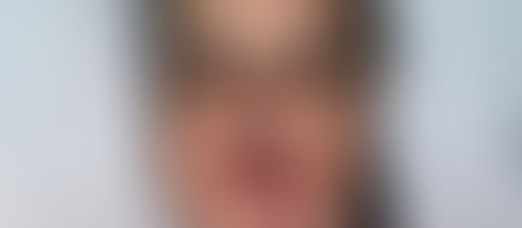 Screaming Without a Voice: The Reality of the "Bridge to Care" Gap