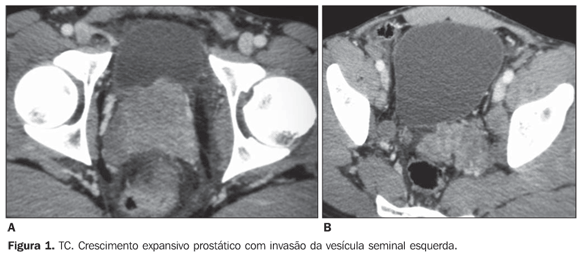 a13fig01.gif