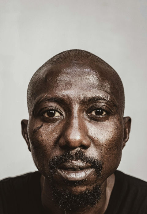 Bald Black man with a scar on his cheek