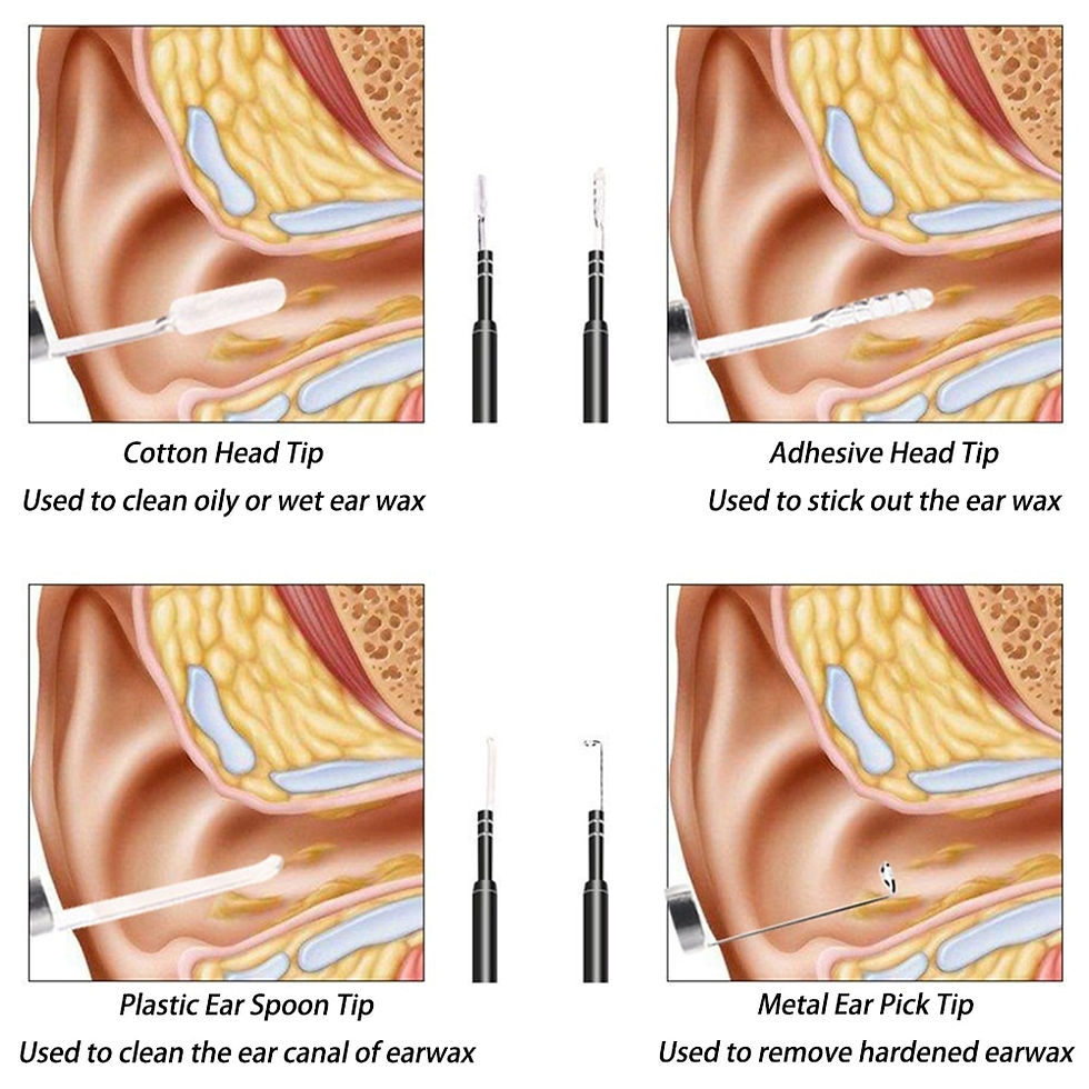 الصورة المصغرة: Smart Visual Medico Otoscopio Ear Cleaner Ear Endoscope Earpick Camera Ear Wax