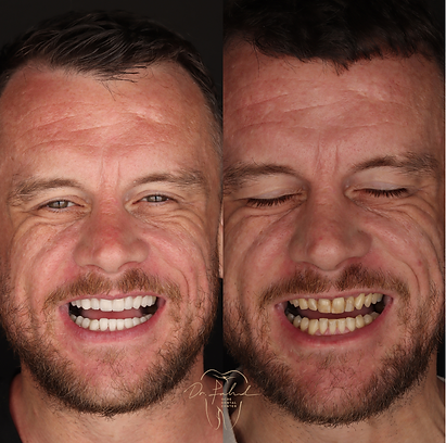 Untitled design (4).png